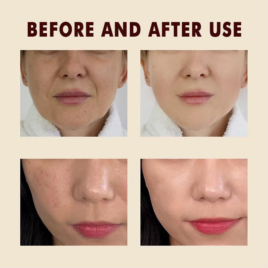 Peel Shot Glow, Black Rice Peeling Ampoule