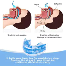 Anti Snore Bruxism Mouth Guard
